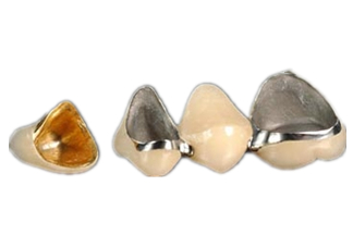 Dental Crowns & Bridges