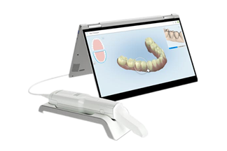 iTero Digital Impressions Scanner